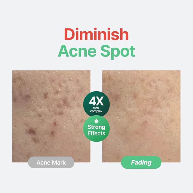 PURITO Centella Unscented Serum for Sensitive Skin – Lightweight Calming & alternate view 3