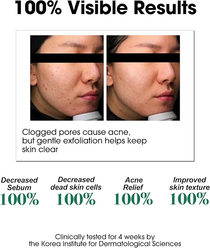 SOME BY MI AHA BHA PHA 30 Days Miracle Toner – 5.07oz alternate view 4