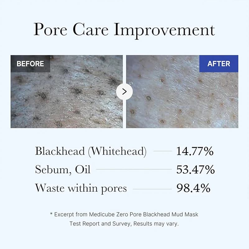 Medicube Zero Pore Blackhead Mud Facial Mask - Skin Cooling & Pore alternate view 2